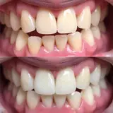 qualified Cosmetic Dentists